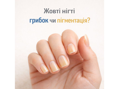 Жёлтые ногти: грибок или косметическая проблема? Как понять и что делать
