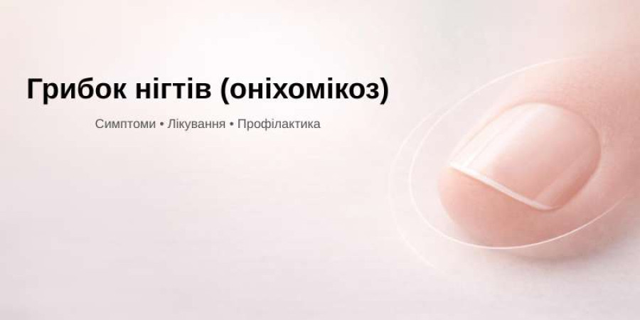 Грибок нігтів: симптоми, лікування та профілактика (оніхомікоз)