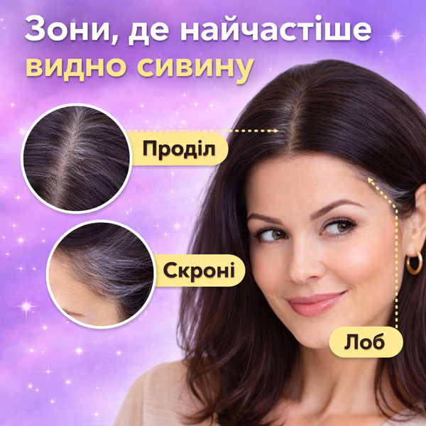 где чаще всего появляется седина на волосах пробор виски лоб